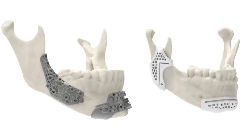 An image showing a 3D-printed model of mouth jaws, created for medical device applications.